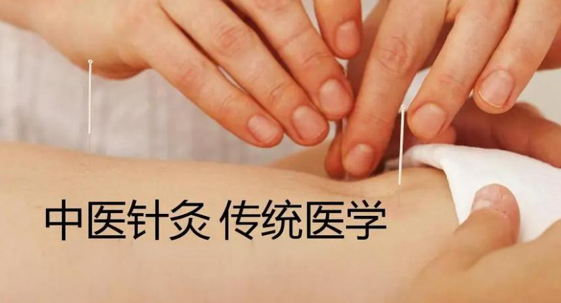 中医针灸