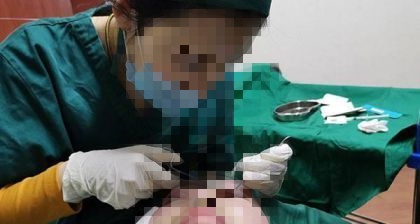 面部微调技术培训学校推荐