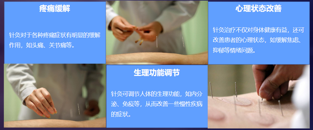 中医针灸技能培训机构